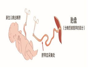 一般储存脐带血几年合适？